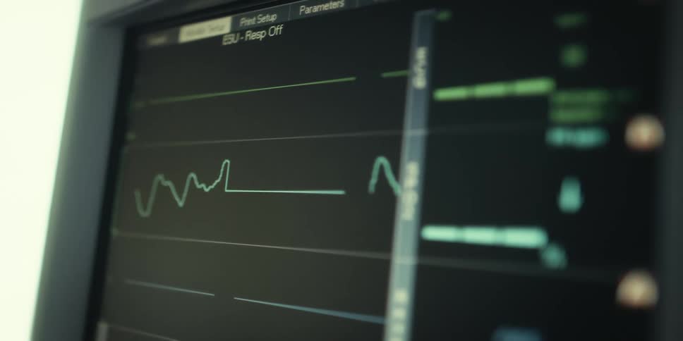 Closeup of a heart monitor displaying vital signs