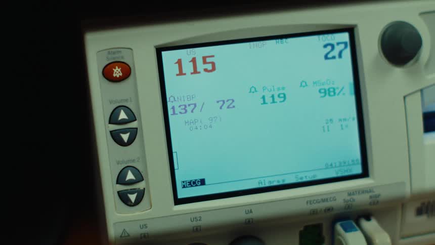 Medical monitor shows vital signs including blood pressure heart rate and oxygen saturation