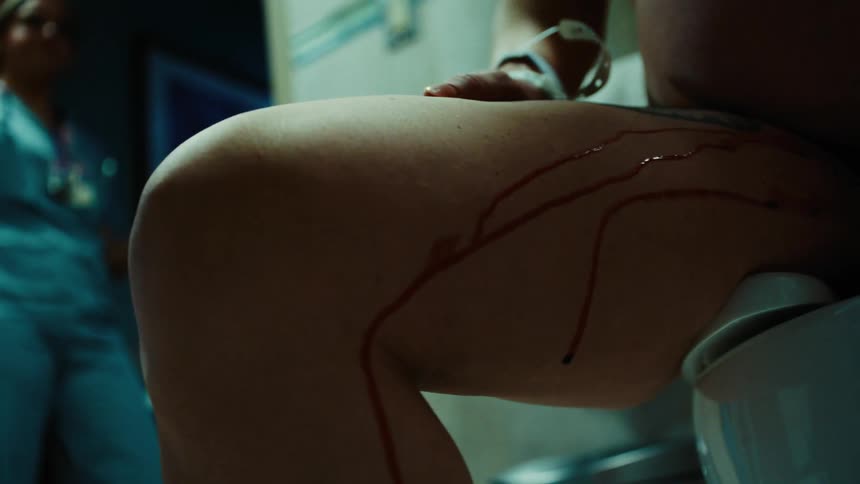 Person with blood dripping down their legs sitting on a toilet in front of a nurse