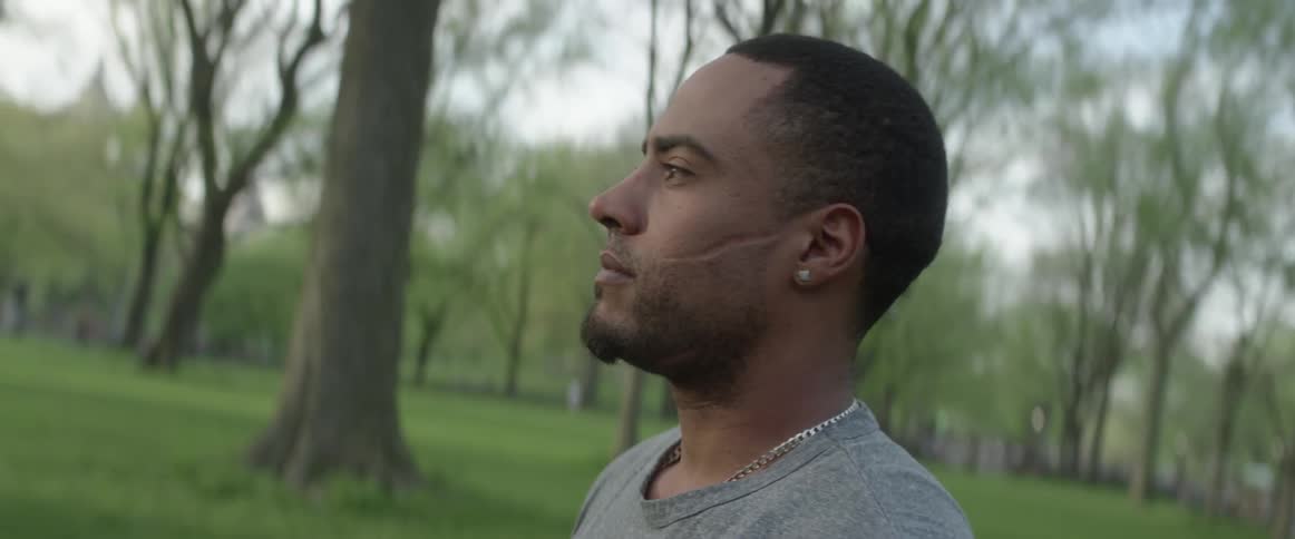 A man with a scar on his face stands and looks in the distance