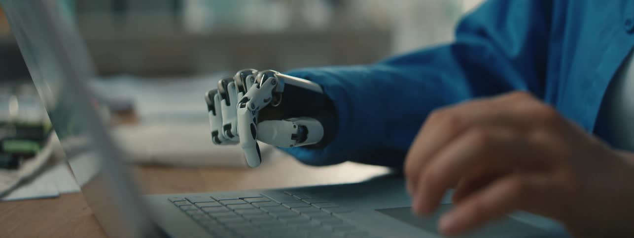 A woman is typing on a laptop with a prosthetic hand