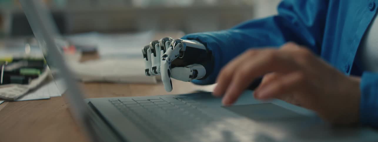 A woman with a prosthetic hand using both her hands to type on a laptop keyboard