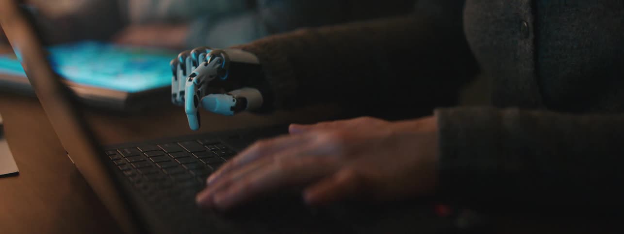 A person with a robotic prosthesis hand with metal components presses keys on a laptop keyboard