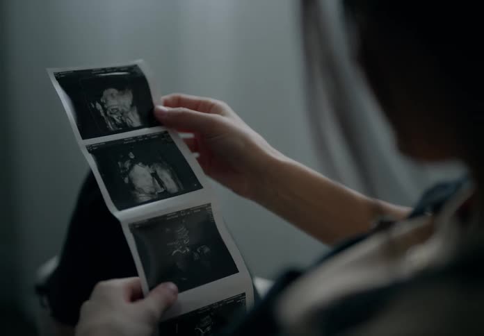 Woman sitting watching ultrasound
