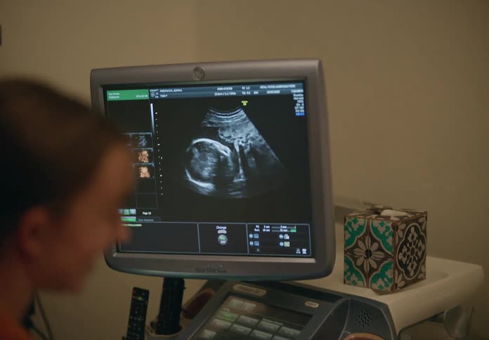 A closeup of an ultrasound screen reveals a baby