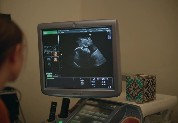 Medical professional interacts with the ultrasound image displayed on the machine monitor
