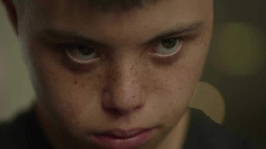 Closeup of the face of a freckled child with Down syndrome