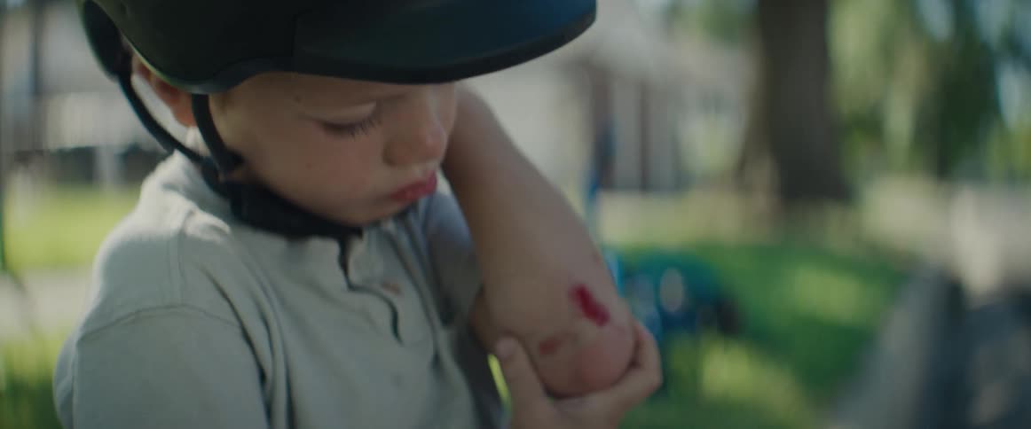 Little boy wearing a helmet sitting on a street in a neighborhood with a scrape on his elbow