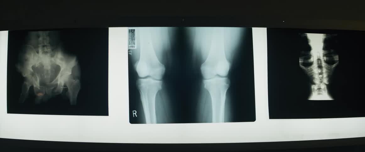 Screen lighting up with body part xray scanners