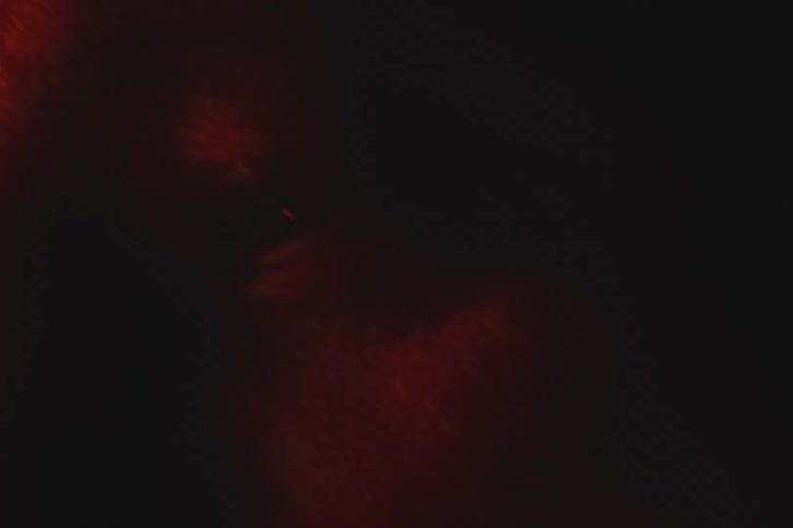 Portrait of a person with watery eyes