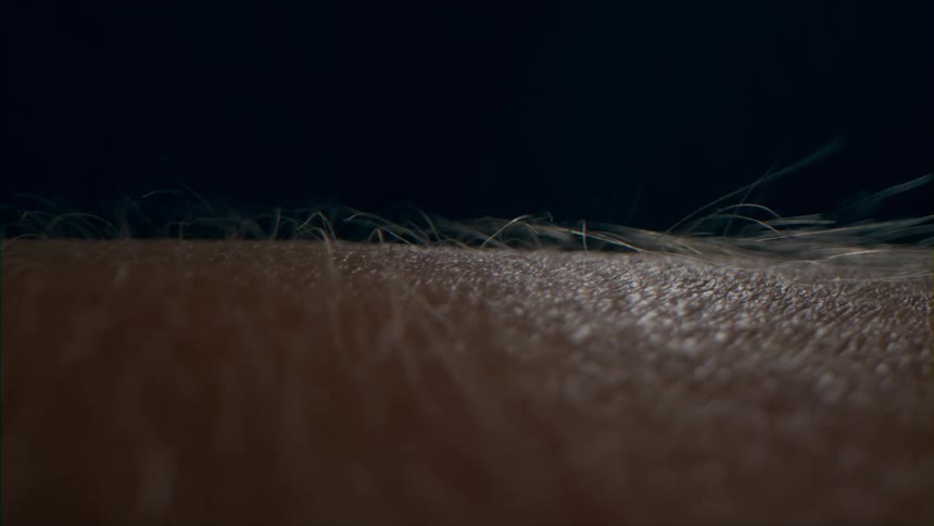 Close Up of Goosebumps on an Arm