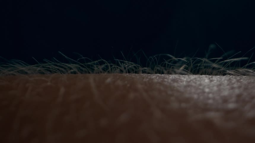 Closeup of a persons arm getting Goosebumps
