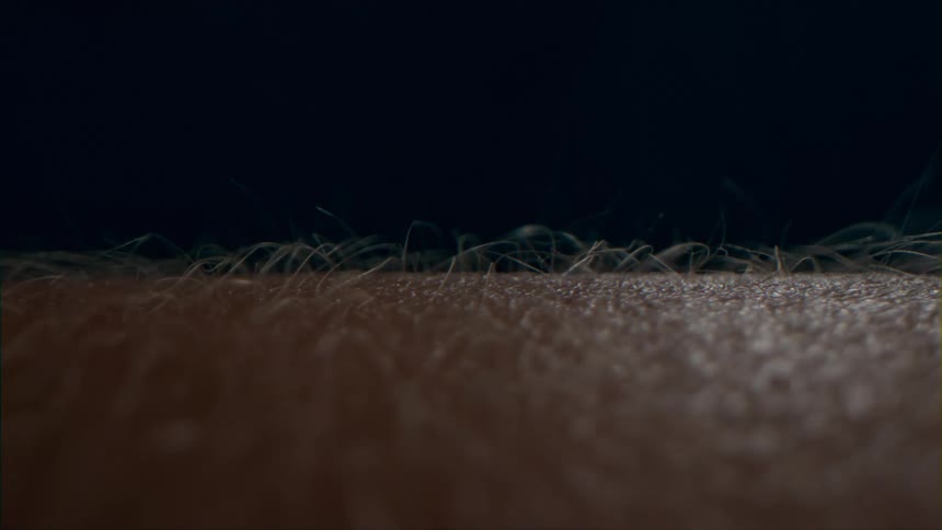 Patch of body hair on a human hair getting spiked by goosebumps indoors