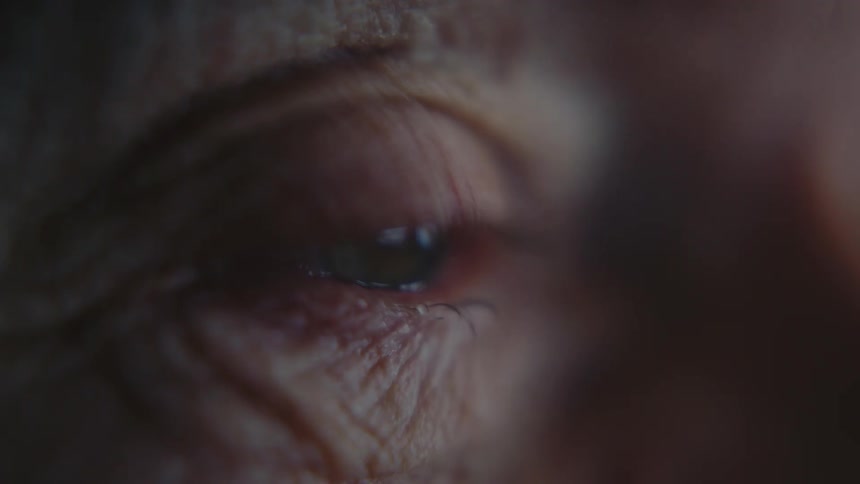 The wrinkled skin and glassy surface of an elderly persons eye reflecting light