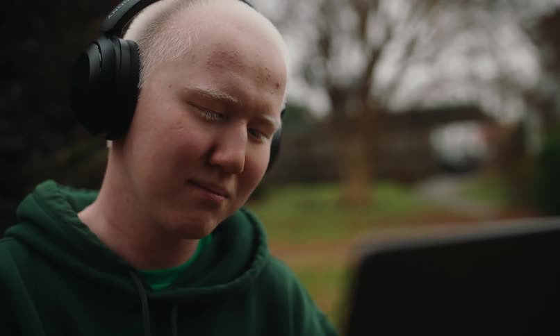 A young man with albinism wears headphones and a green hoodie looking down with a slight smile