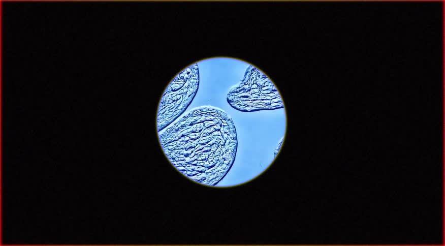 Cells in a blue liquid viewed under a microscope