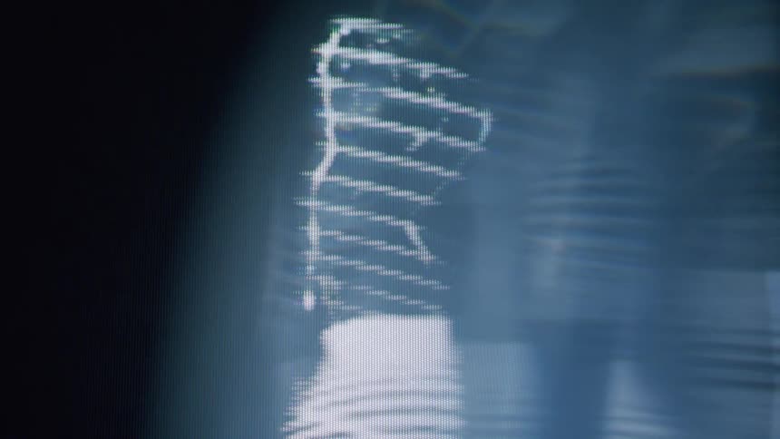 Graphics of blue bodies