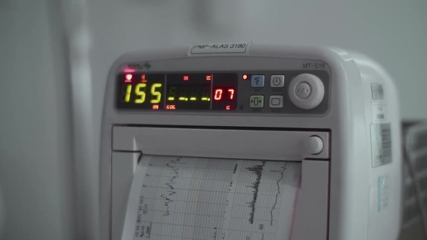 The machine is printing pages of graphs