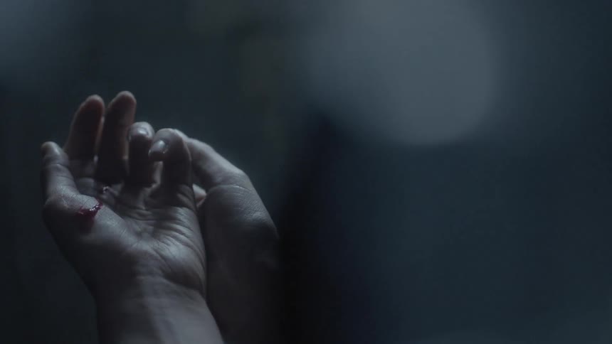 A person opens their bleeding hand
