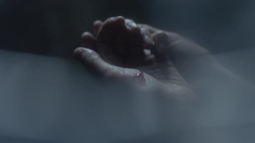 A person shows their hand which is bloody