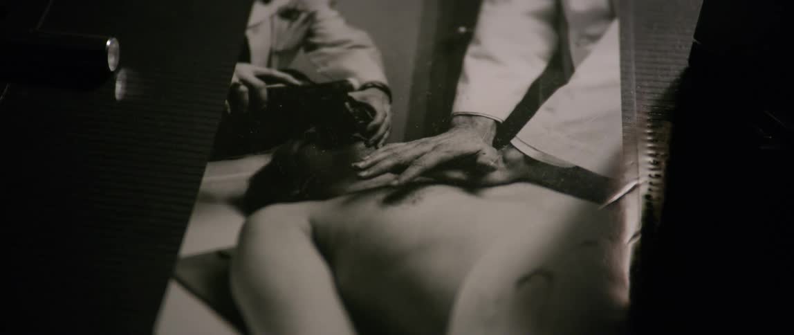 A man receives chest compressions and oxygen from medical staff members
