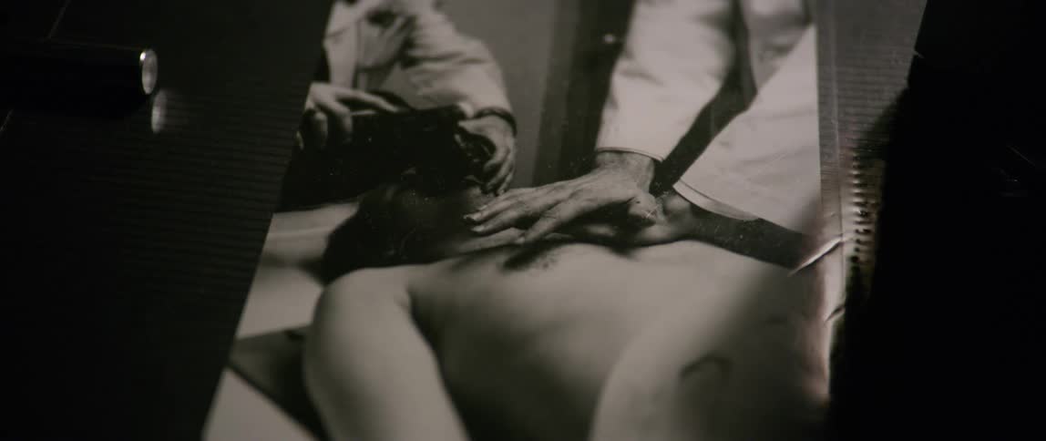 An object is pulled away from the black and white photo of a man receiving cpr