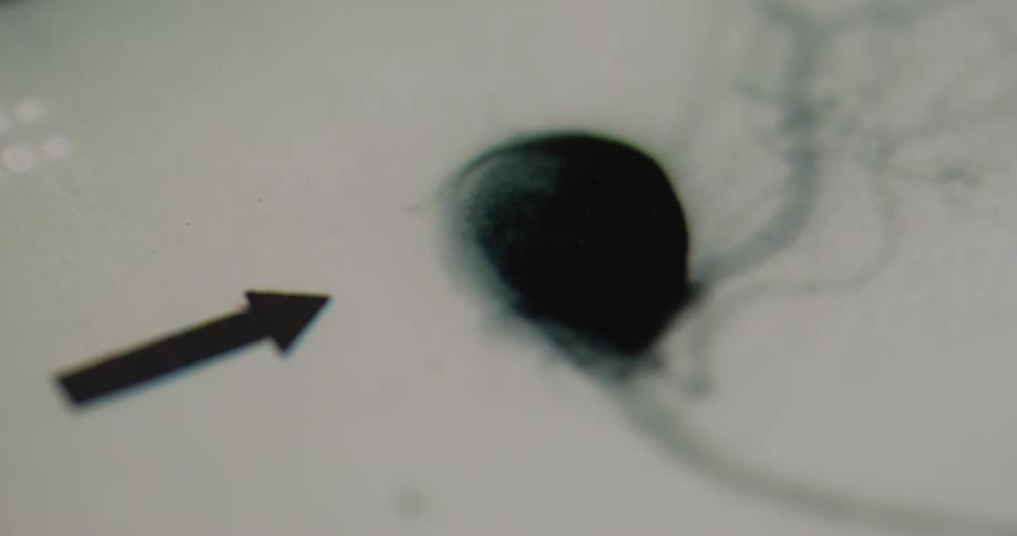 Dark arrow points to an illustration on a white background