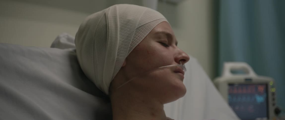 Sad female patient with head wrapped in bandages laying in hospital bed