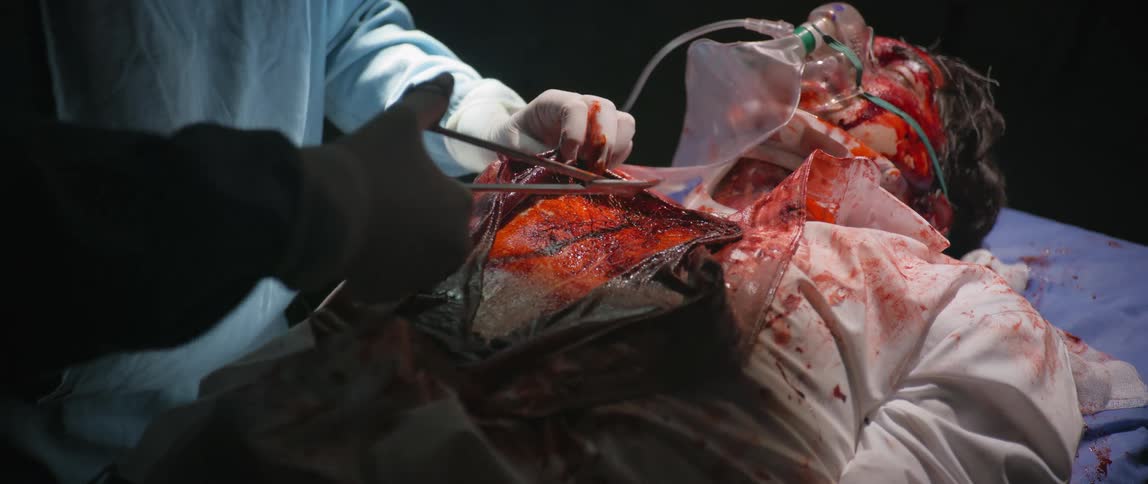 Trauma patient covered in blood laying on gurney having his shirt cut by medical professionals