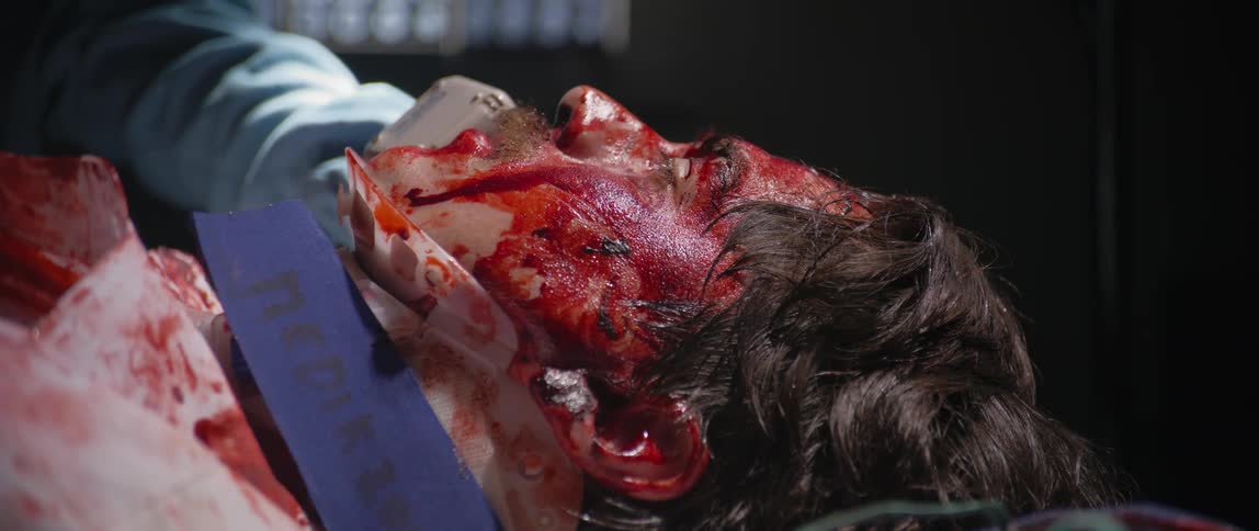 Male patient lying with bloody head on a hospital gurney undergoing surgical procedure