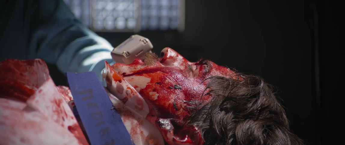 A dying man covered in blood is helped by a nurse to say his last words over the phone