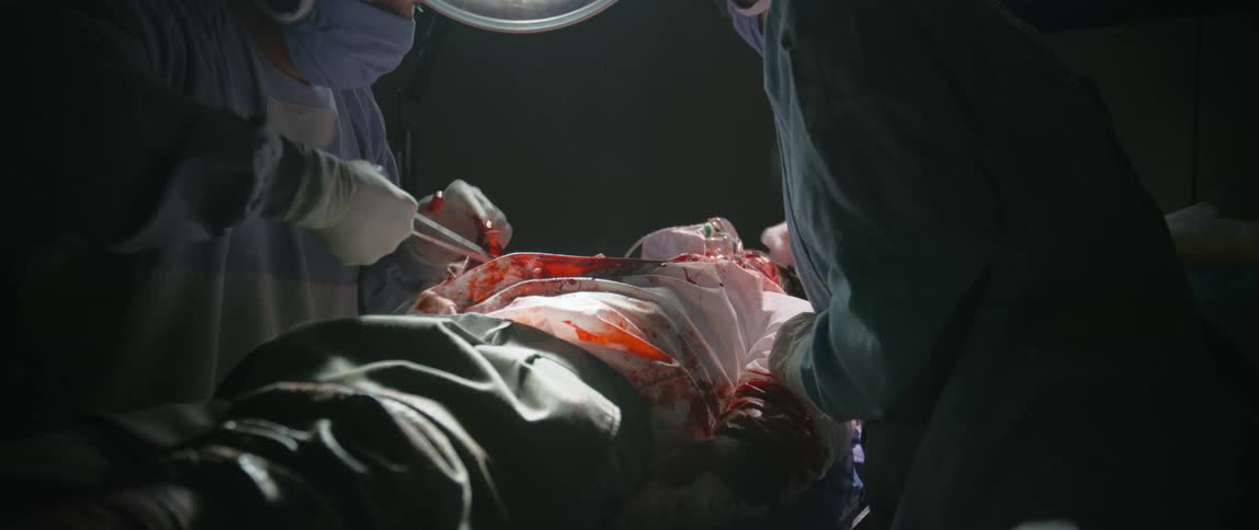 Two surgeons are operating on a bloody patient