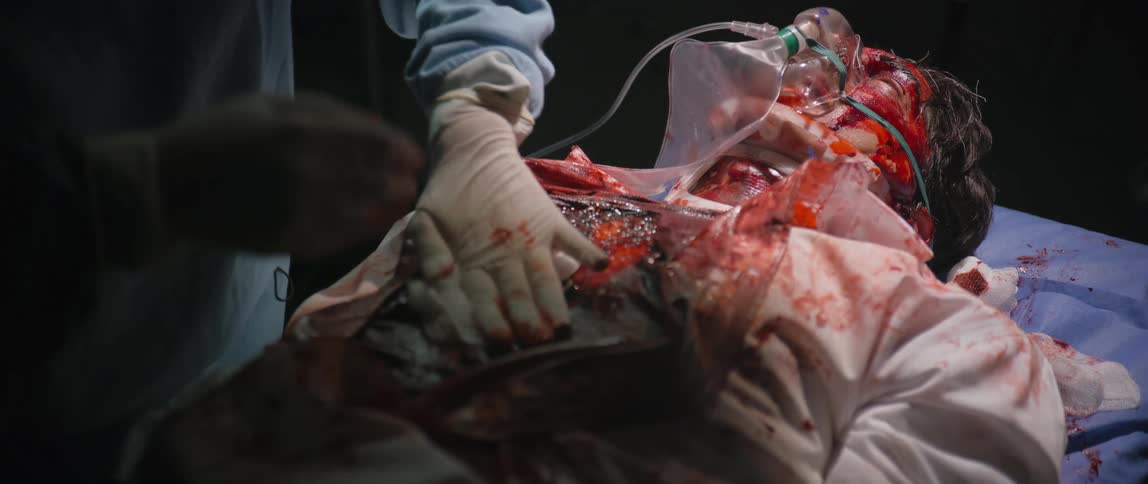 A wounded man bleeding in a hospital bed with two doctors trying to stop the bleeding from his chest