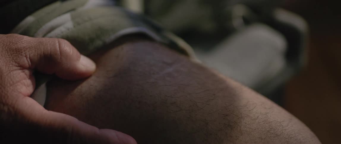 A man punches the scar on his leg