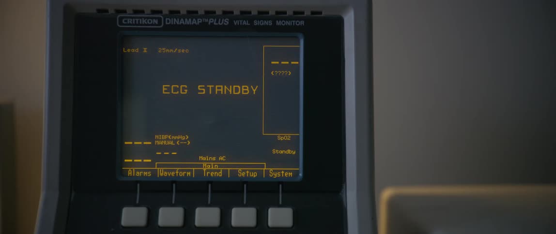 The display on the vital signs monitor is on