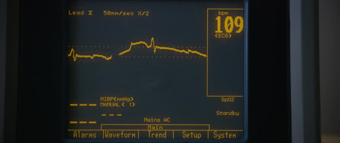 A vitals monitor displays various medical readings on its screen