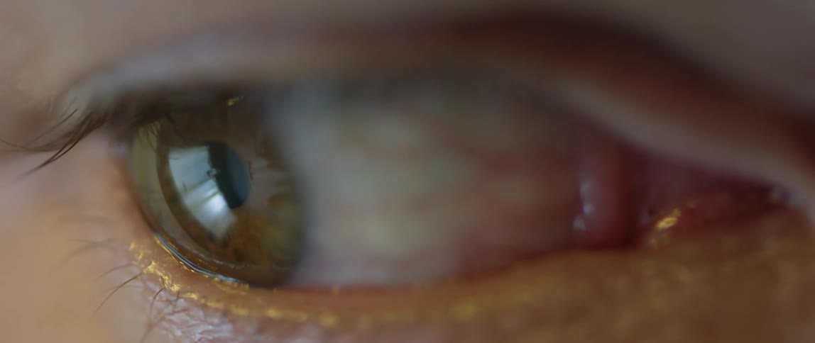 A persons eye looks around