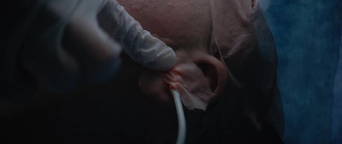 Gloved hand placing a sticker on a tube into the ear of a lying patient