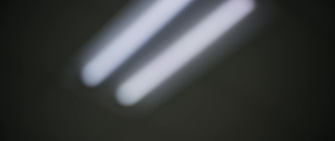 Blurry view of a hospital room ceiling and blinking neon lights