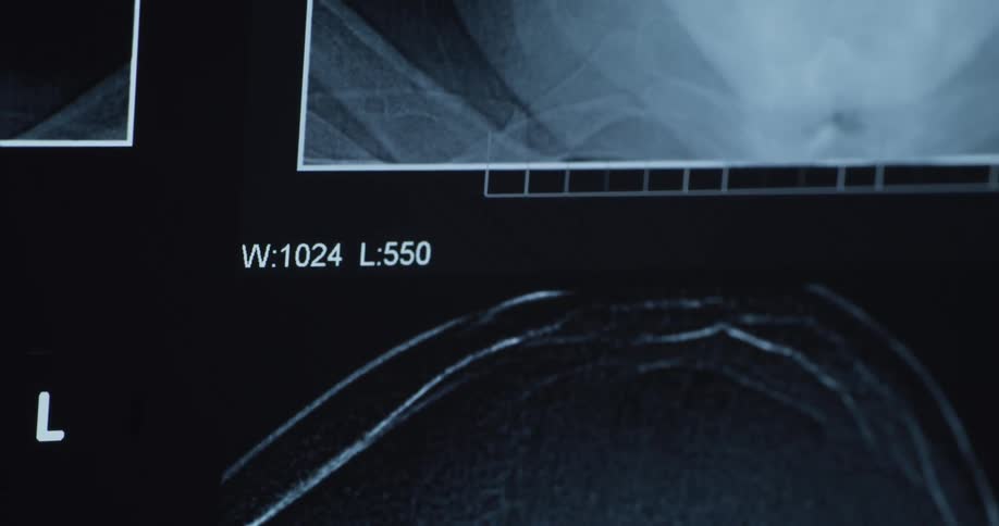 A closeup digital xray or medical scan displays grayscale anatomical structures with overlaid imaging parameters