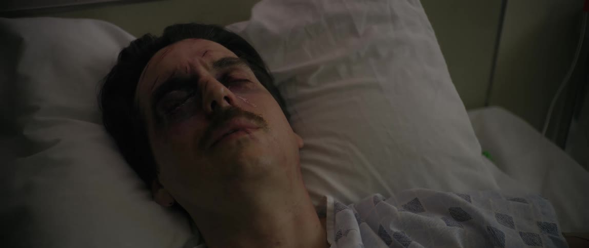 A severely bruised man lies in a hospital bed motionless and staring upward in low lighting suggesting trauma or recovery