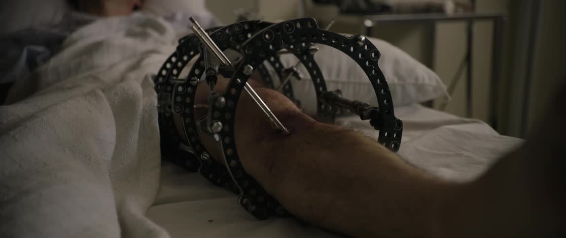 A man has a brace on his leg in a hospital bed