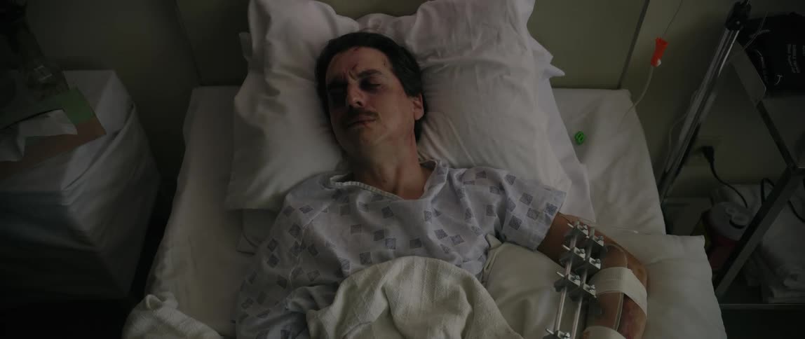 A man lies injured in a hospital bed with a medical brace on his arm appearing weak and contemplative