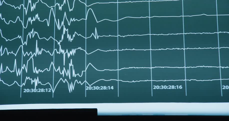 A chart is on the display