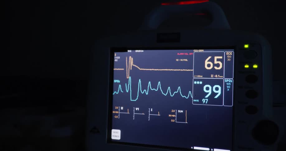The camera focuses in on a heartrate monitor where the top ecg number steadily decreases until flat lining at zero