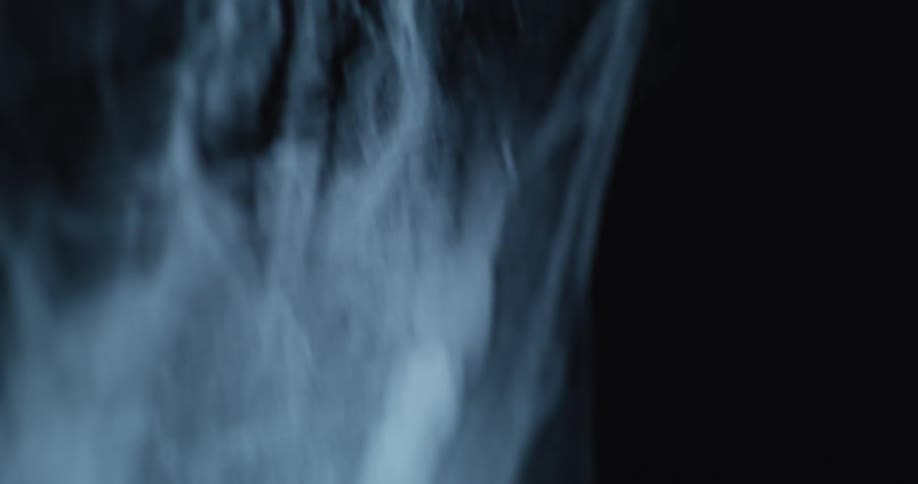 The xray shows imaging of a person