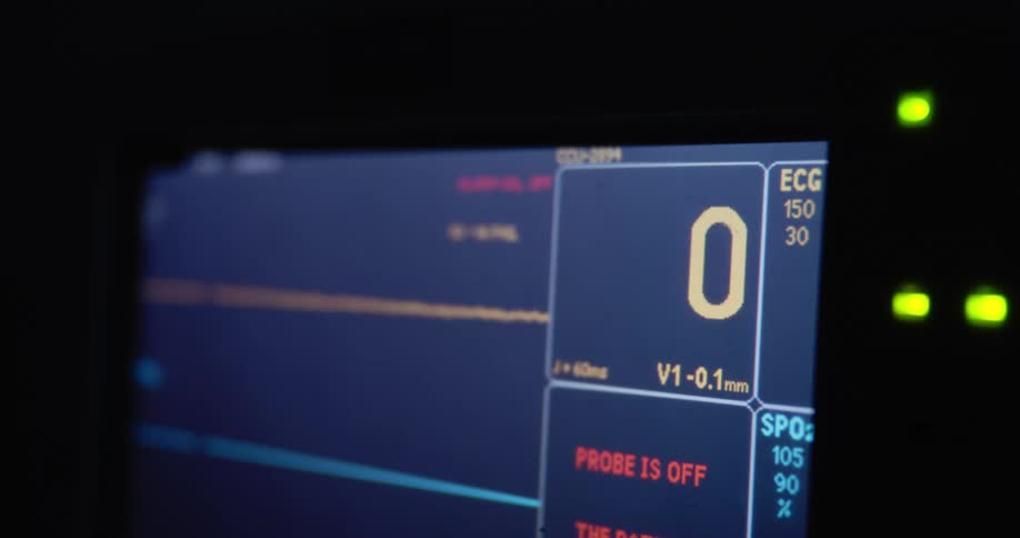 The image displays an electrocardiogram ecg tracing showing a heart rate of 72 beats per minute and oxygen saturation level of 90