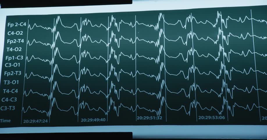 Large monitor displays the results of a electrocardiogram