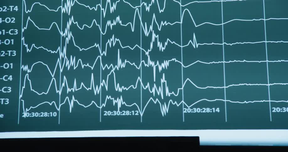 A graph is on the monitor