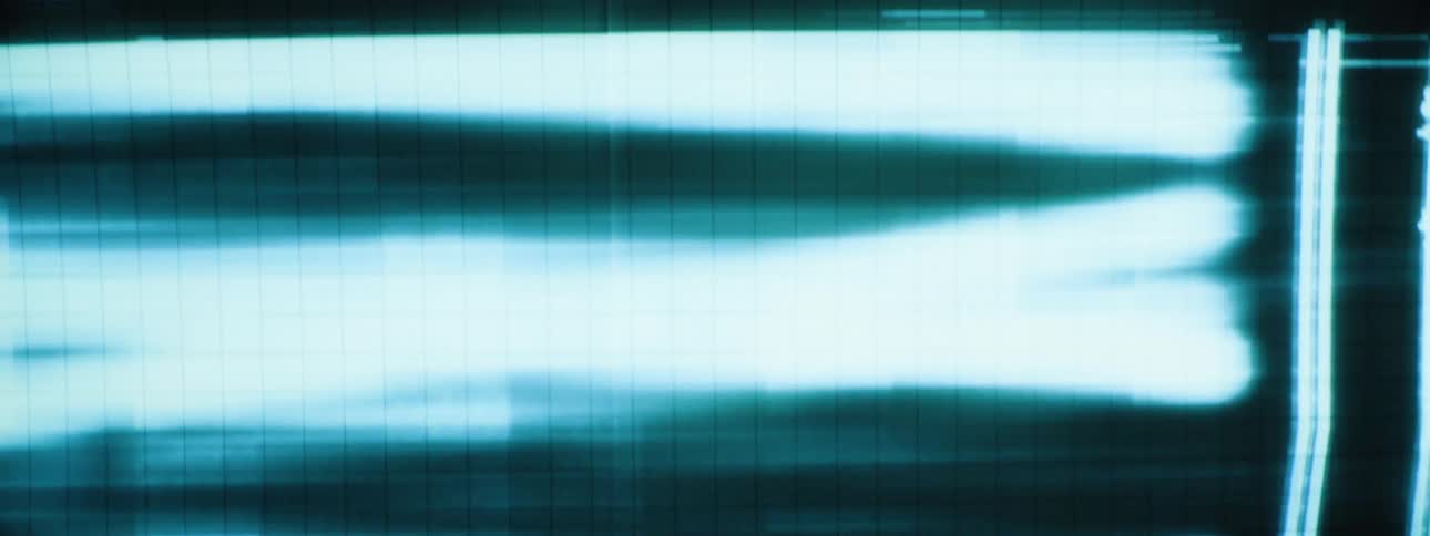 The lights from a projector flash on the wall